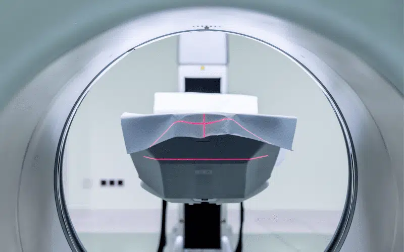 What is an MRI and what is it used for?